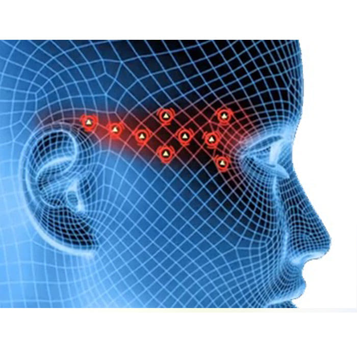 Blue 3D graphic of a human head with a grid pattern and red marked dots in the area of the temples